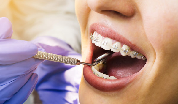 Ortodoncia general en la clínica dental José Bergamín